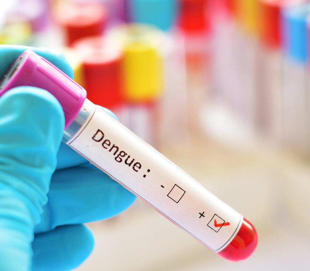 Cuba está desarrollando una vacuna que sirva para los cuatro serotipos del virus del dengue. 