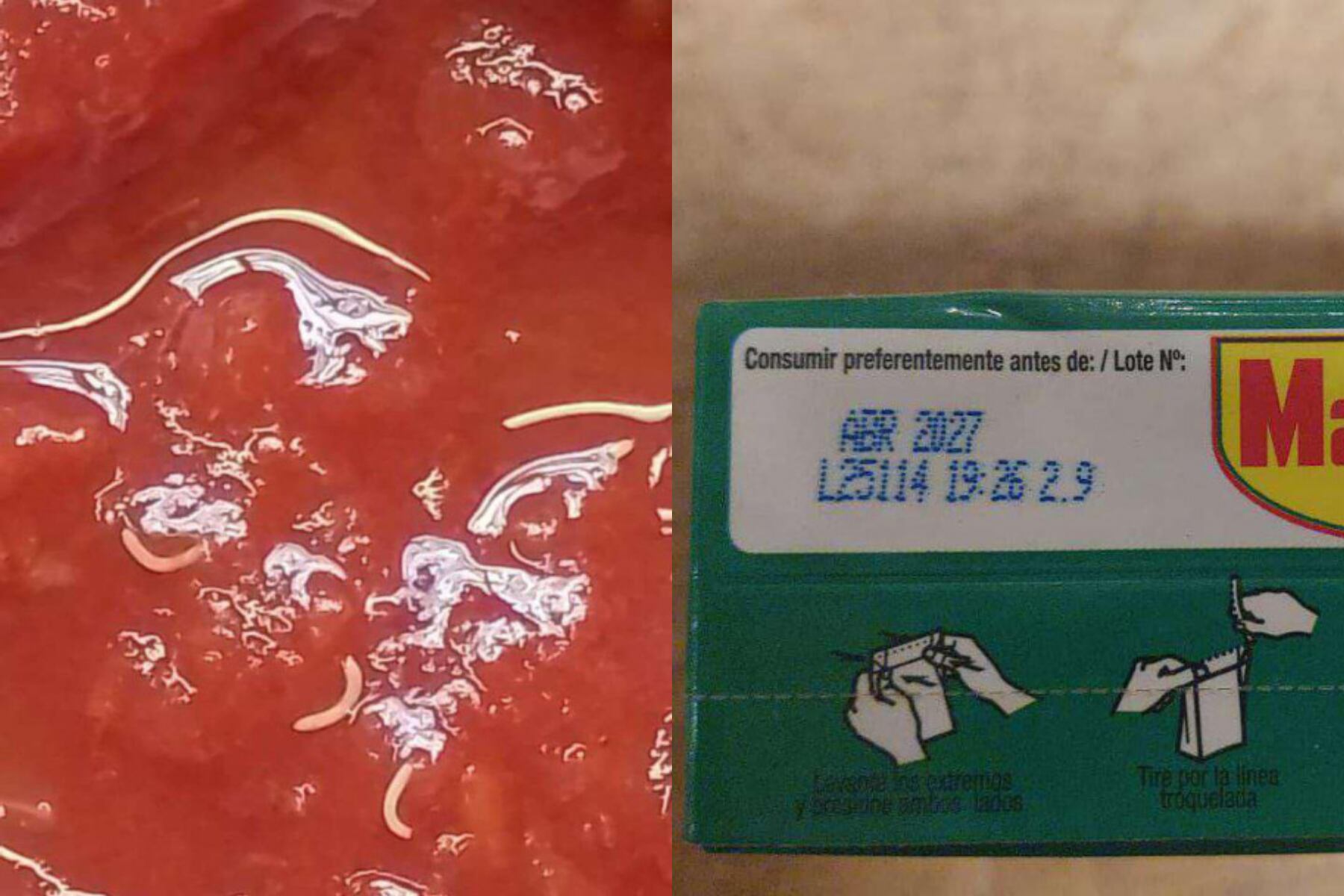 De acuerdo con la información oficial, el estudio realizado con lupa estereoscópica binocular con aumento 2X permitió comprobar que lo hallado no eran parásitos